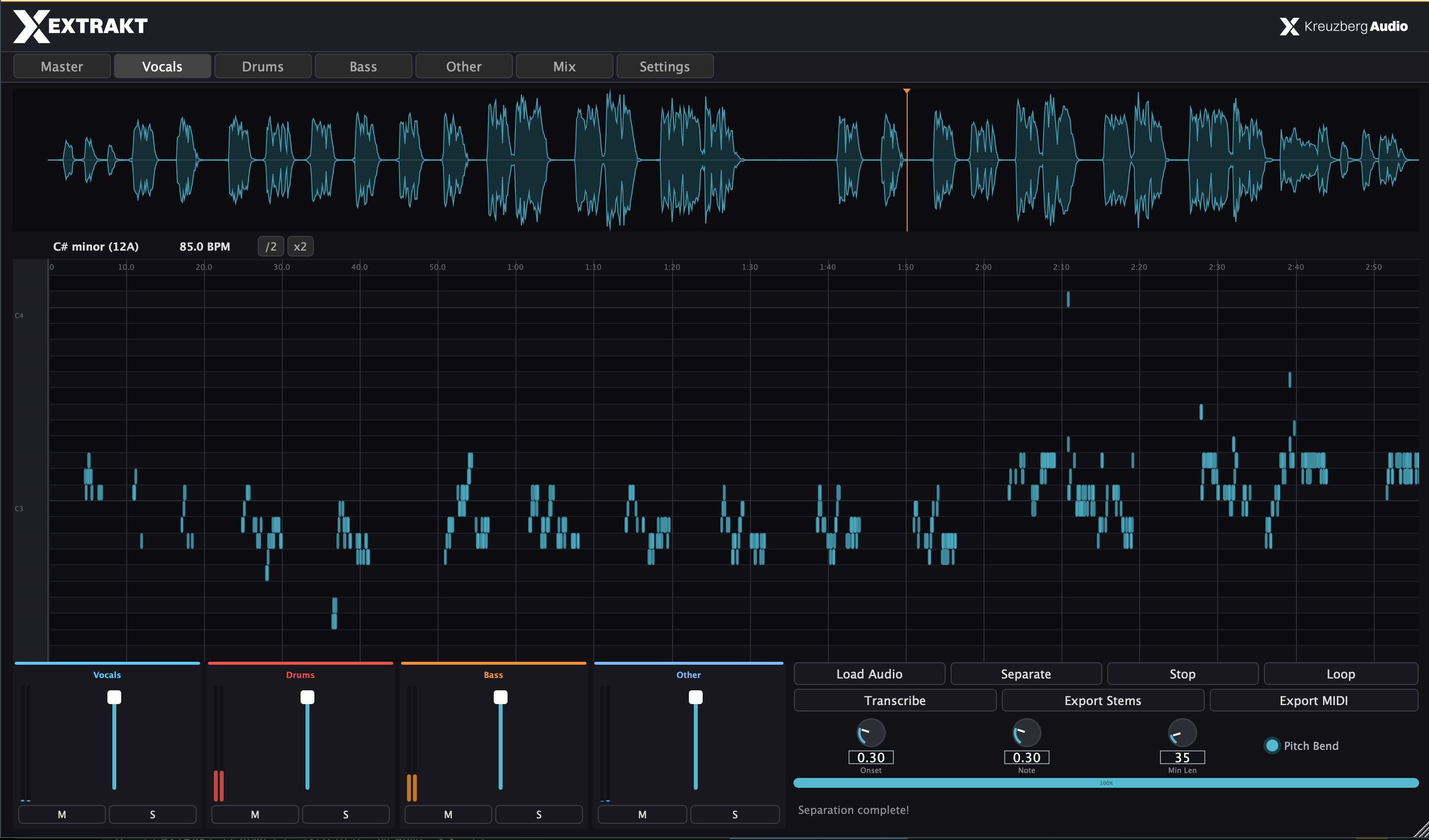 EXTRAKT — Vocals MIDI